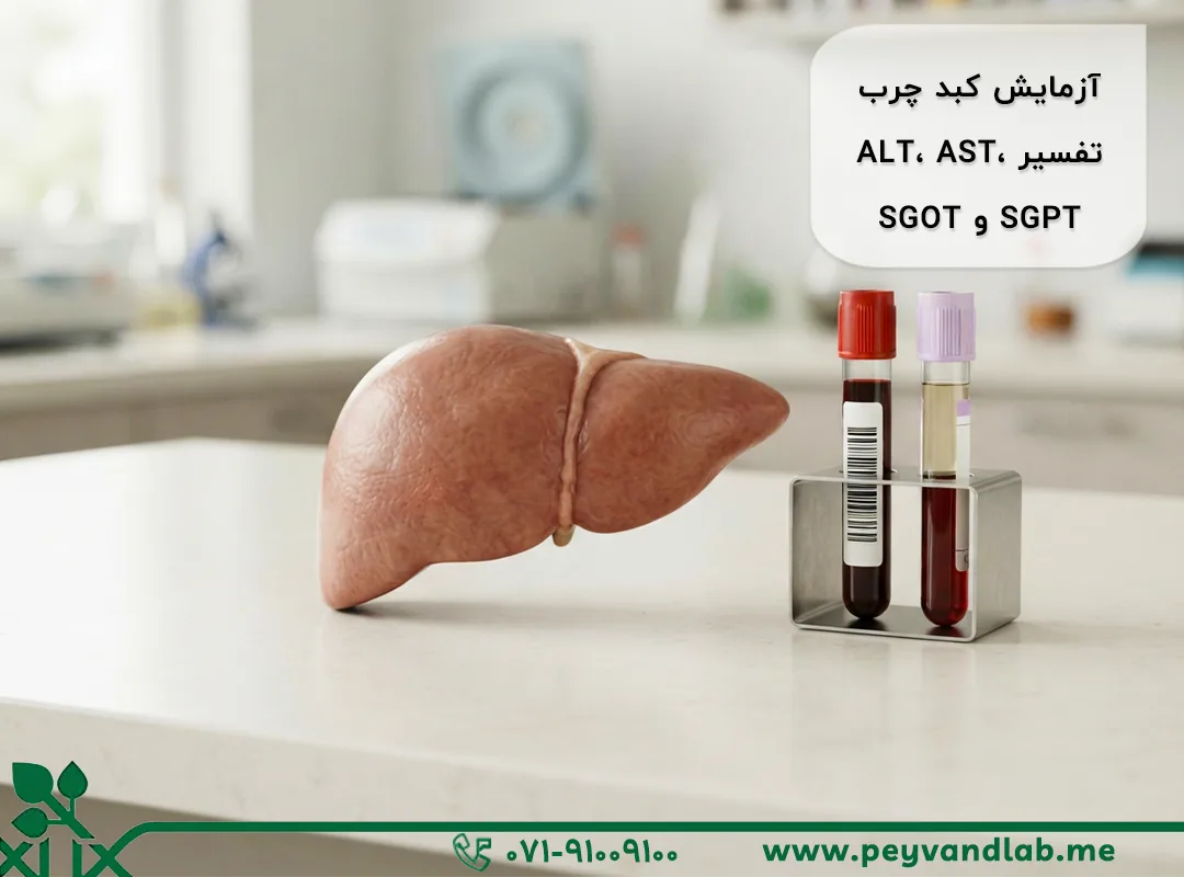 آزمایش کبد و کبد چرب | تفسیر ALT، AST، SGPT و SGOT