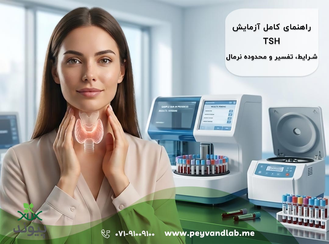 آزمایش TSH در شیراز |تفسیر نتیجه و رنج نرمال تیروئید