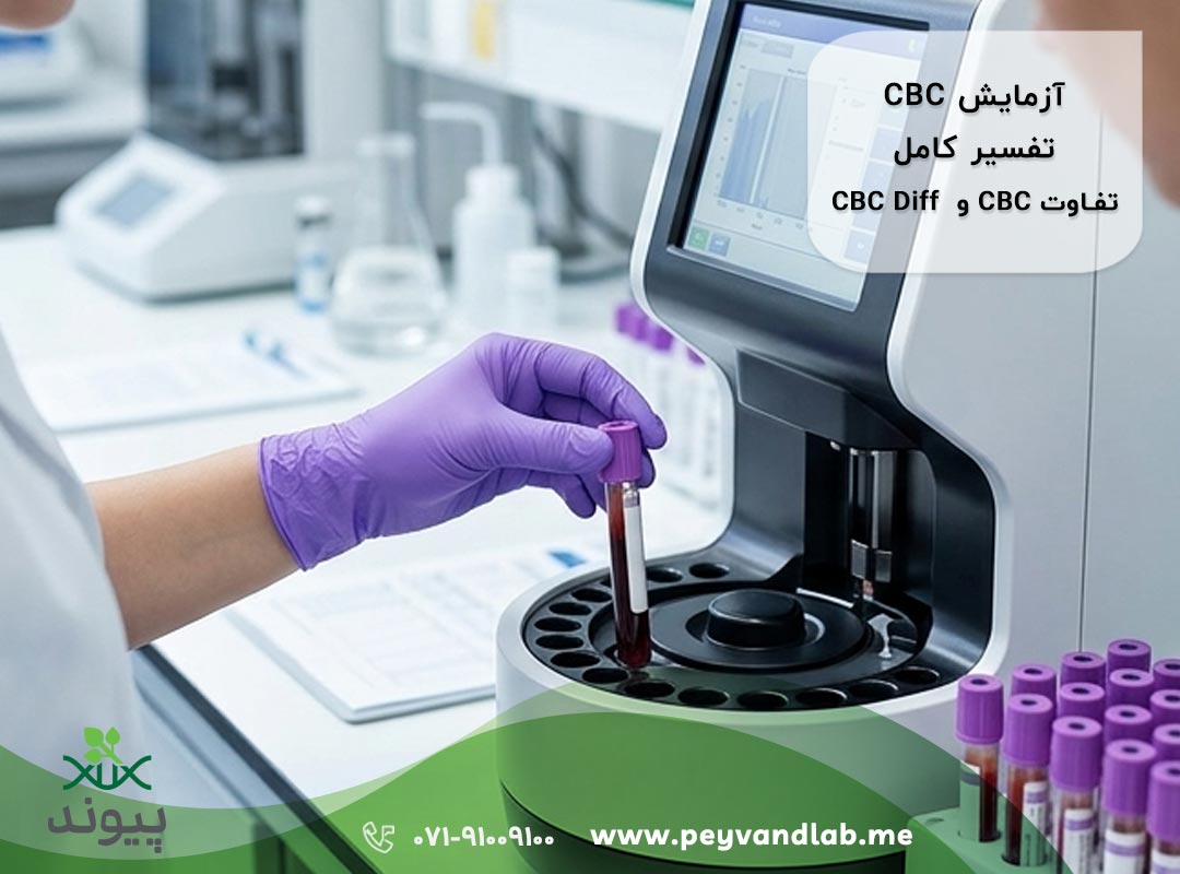 آزمایش CBC در شیراز؛ تفسیر جواب CBC و CBC Diff