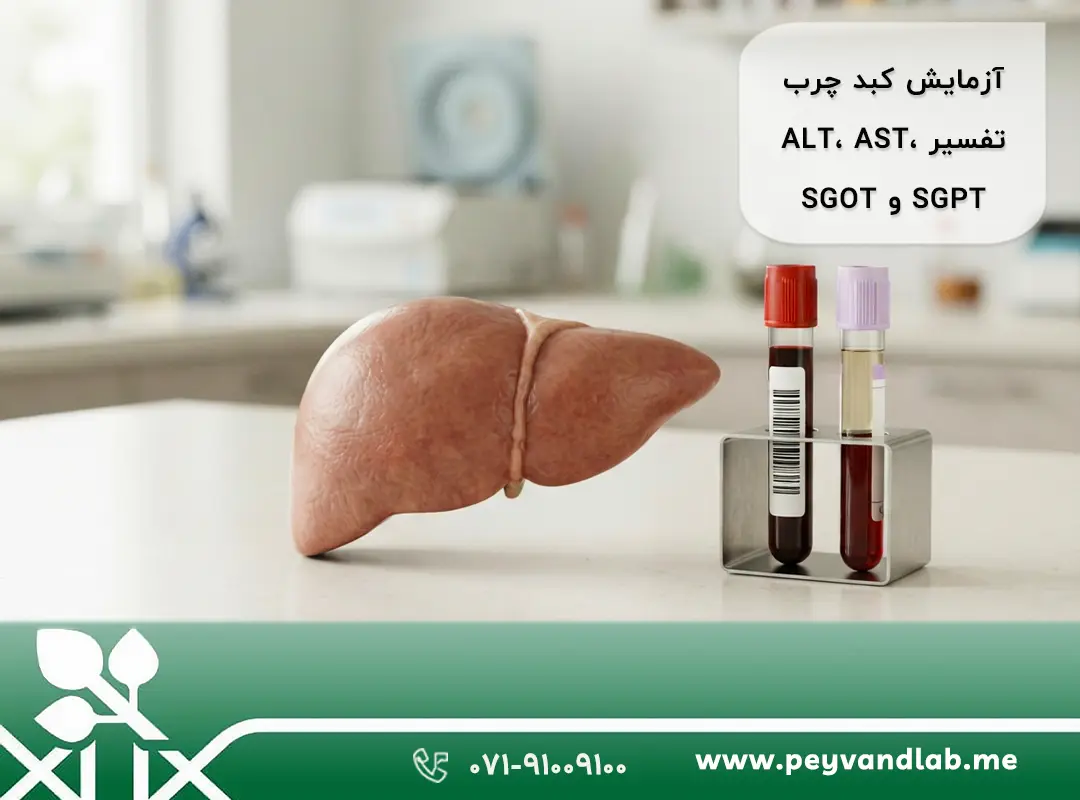 آزمایش کبد و کبد چرب | تفسیر ALT، AST، SGPT و SGOT