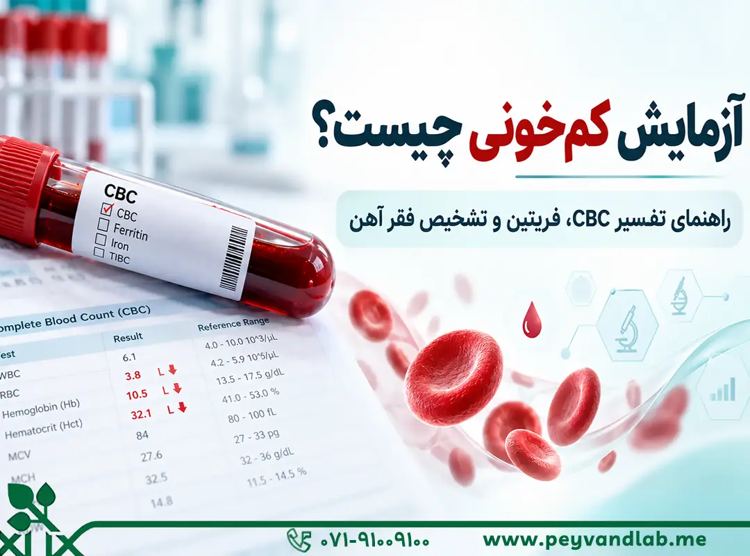 آزمایش کم‌خونی چیست؟ تفسیر CBC، فریتین و تشخیص فقر آهن