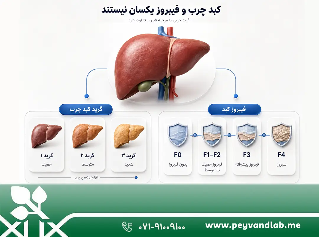 فرق کبد چرب با فیبروز کبدی