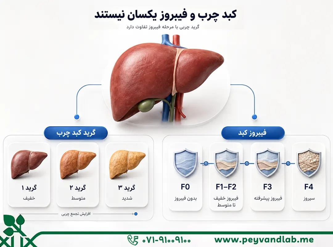 فرق کبد چرب با فیبروز کبدی 